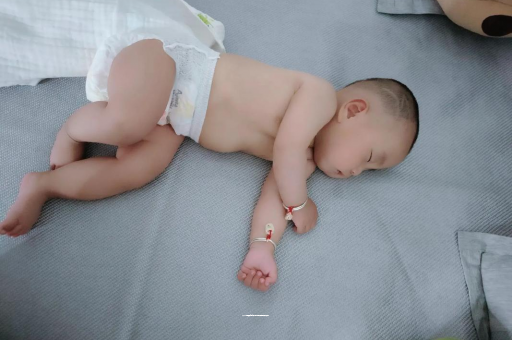 嘉兴六个月宝宝眼睛散光